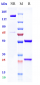 Anti-Complement C5 Reference Antibody (vilobelimab)